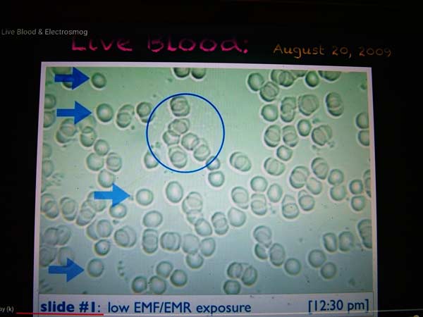 Red blood cells fairly normal with low EMF exposure